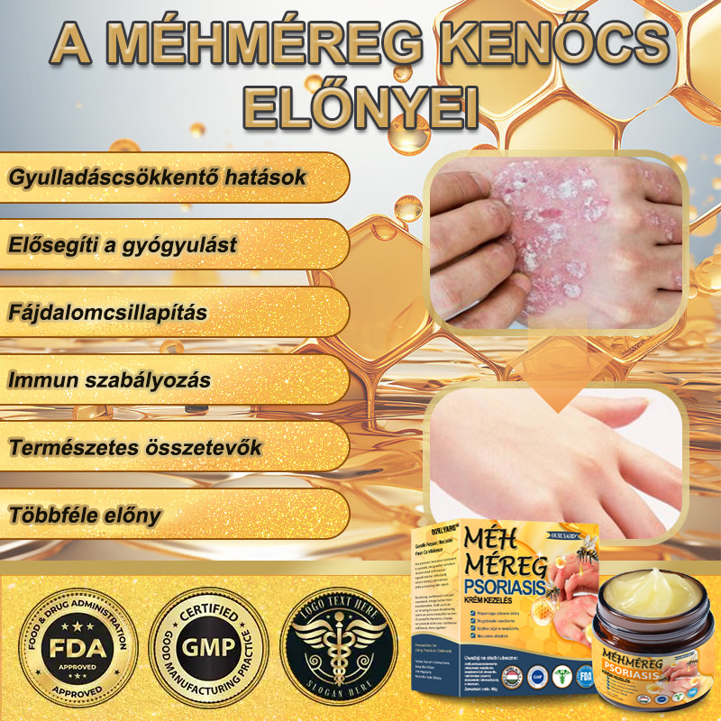 Ourlyard™ Méhméreg Haladó Psoriasis Kezelő Kenőcs (👨Orvos által ajánlott)