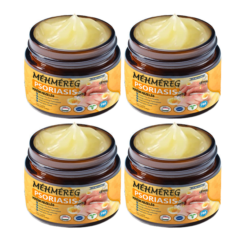 Ourlyard™ Méhméreg Haladó Psoriasis Kezelő Kenőcs (👨Orvos által ajánlott)