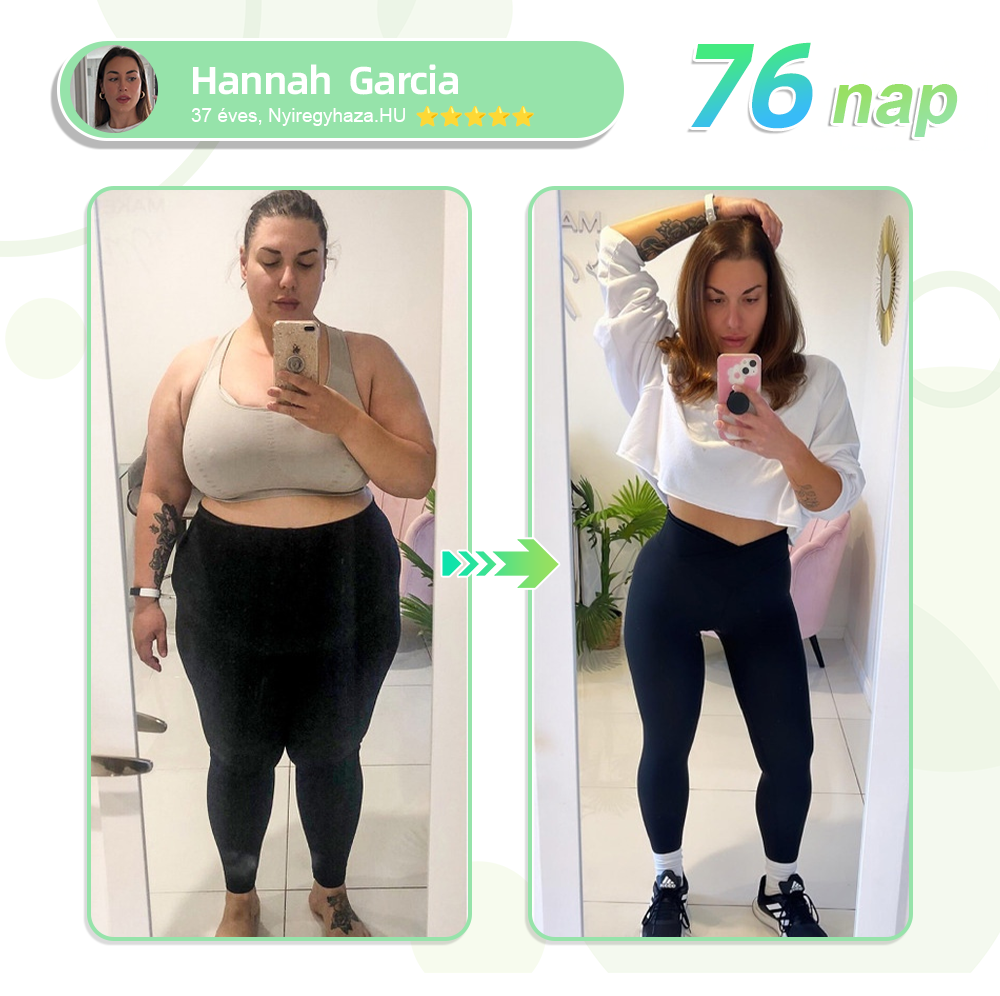 𝗧𝗟𝗢𝗣𝗔® 𝗚𝗜𝗣+𝗚𝗟𝗣-1 Nano Mikrotűs Tapasz👩⚕️ (Fájdalommentes, hosszan tartó hatás, a cukorbetegség, elhízás és szív- és érrendszeri betegségek kezelésére)✅
