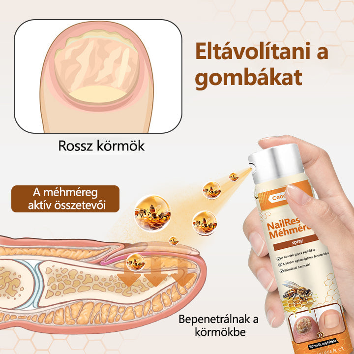 2025🎁 Korlátozott idejű akció 70% kedvezménnyel ️️⏳ Ceoerty® körömgomba spray méhméreggel 💥 2 hét alatt megoldja az összes körömproblémát
