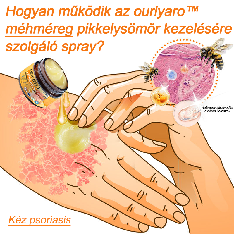 Ourlyard™ Méhméreg Haladó Psoriasis Kezelő Kenőcs (👨Orvos által ajánlott)