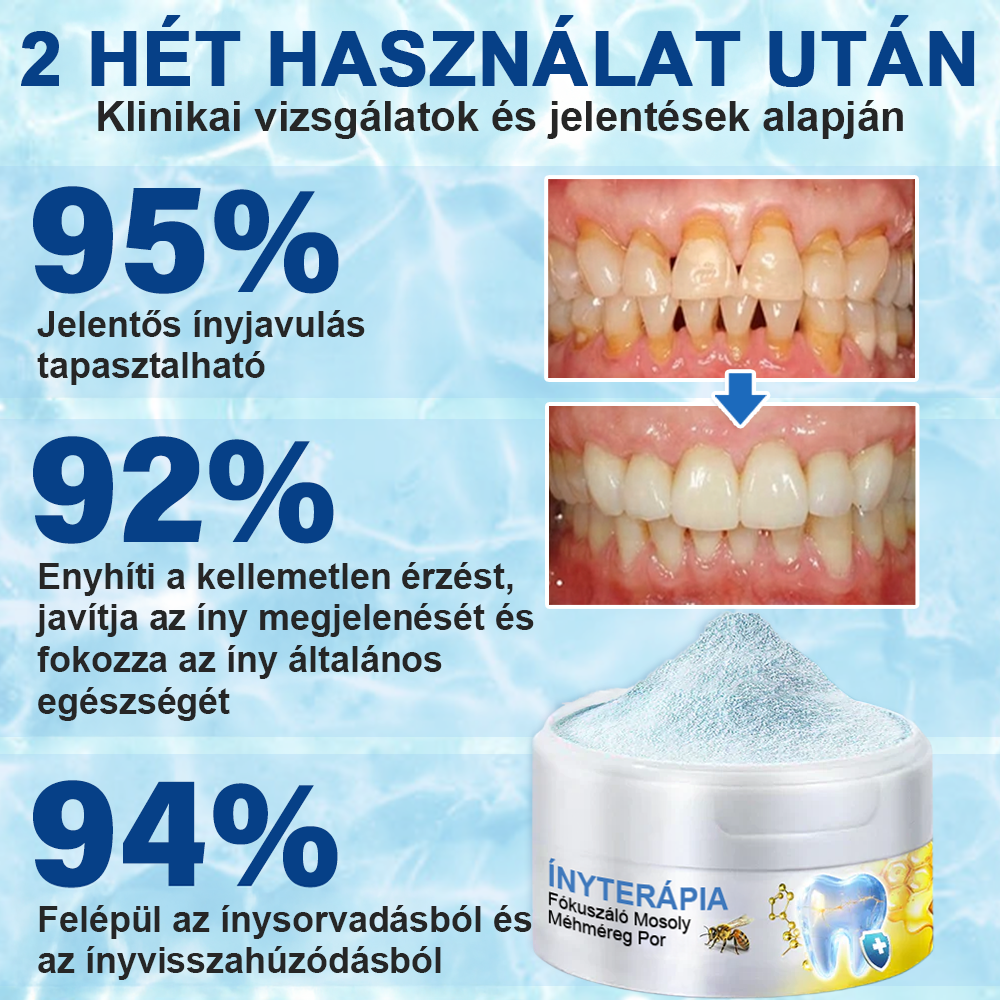 🇭🇺 Furzero® 𝑭𝒐𝒄𝒖𝒔𝒔𝒎𝒊𝒍𝒆 – Méhméreges szájápoló por 🦷
