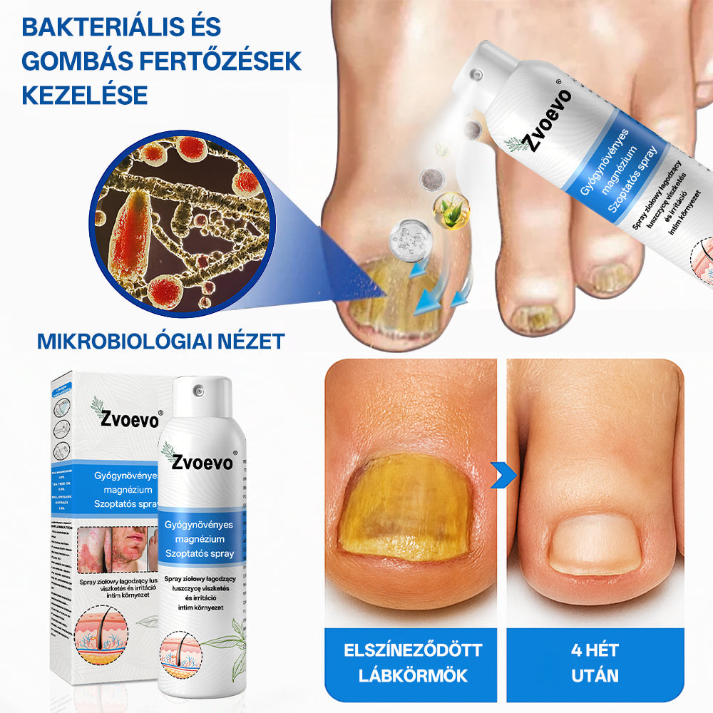 ✅ Hivatalos bolt: Zvoevo® Magnéziumos gyógynövényes spray pikkelysömörre ⚕️ MHRA tanúsítvánnyal (enyhíti a pikkelysömört, ekcémát, kezeli pattanásokat, szemölcsöket, javítja bakteriális fertőzéseket, csökkenti ízületi és neuropátiás fájdalmakat)-1