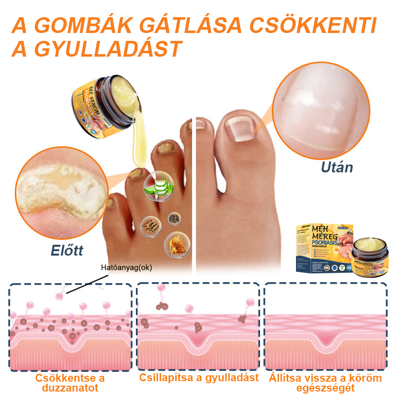 Ourlyard™ Méhméreg Haladó Psoriasis Kezelő Kenőcs (👨Orvos által ajánlott)