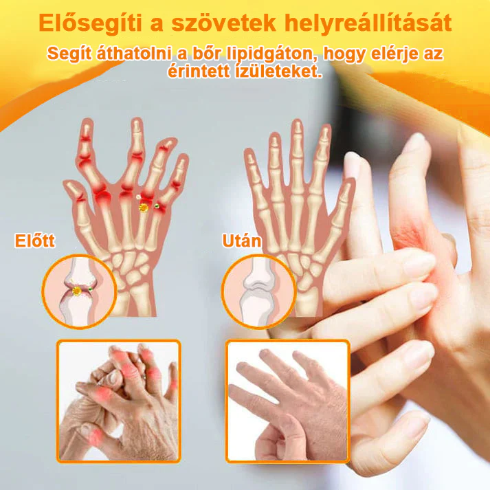✅ Hivatalos áruház: Ourlyard™ Magnéziumolaj és Mézes Ízületjavító Spray 👨⚕️ Jóváhagyva a Magyar Gyógyszerészeti és Egészségügyi Minőség- és Szervezetfejlesztési Intézet (OGYÉI) által. 🔥🔥🔥