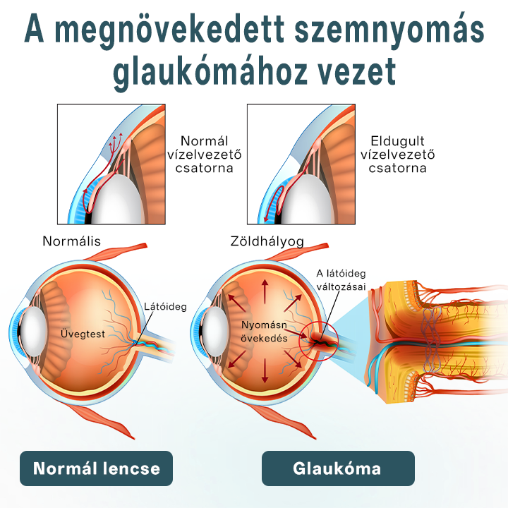 ✅Timilk® OptiFusion Nano szemcsepp szérum⭐
