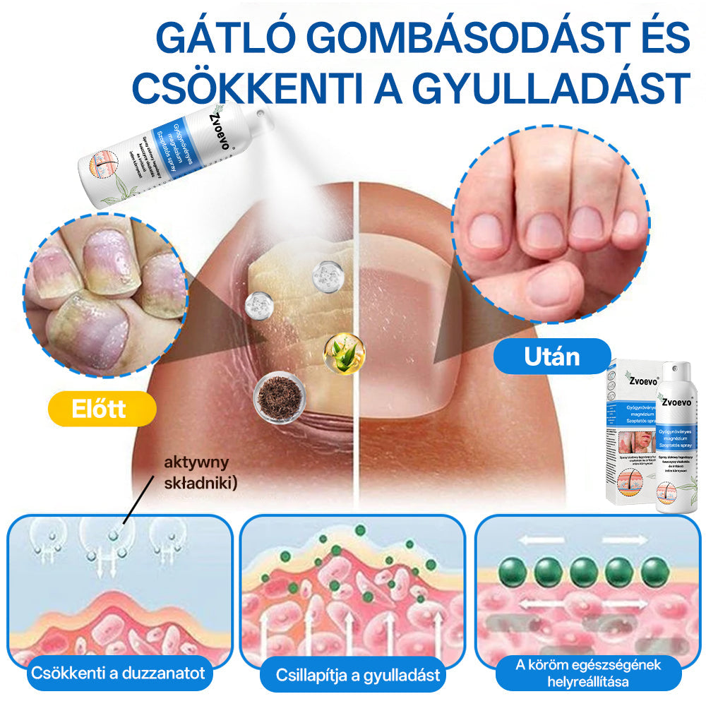 ✅ Hivatalos bolt: Zvoevo® Magnéziumos gyógynövényes spray pikkelysömörre ⚕️ MHRA tanúsítvánnyal (enyhíti a pikkelysömört, ekcémát, kezeli pattanásokat, szemölcsöket, javítja bakteriális fertőzéseket, csökkenti ízületi és neuropátiás fájdalmakat)-1