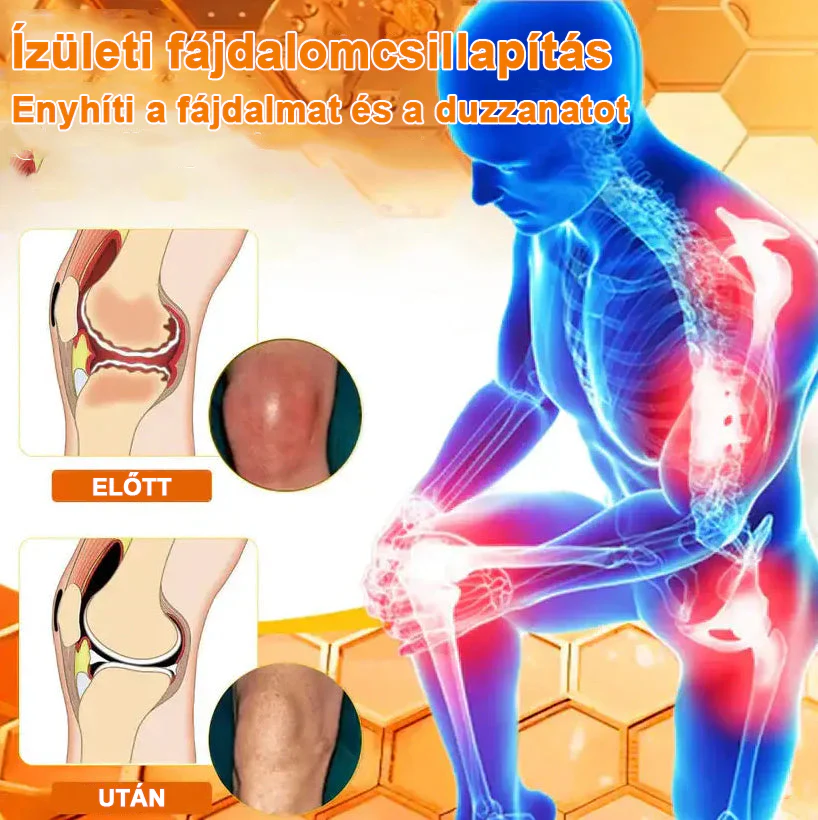 ✅ Hivatalos áruház: Ourlyard™ Magnéziumolaj és Mézes Ízületjavító Spray 👨⚕️ Jóváhagyva a Magyar Gyógyszerészeti és Egészségügyi Minőség- és Szervezetfejlesztési Intézet (OGYÉI) által. 🔥🔥🔥
