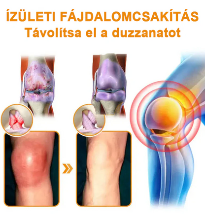 ✅ Hivatalos áruház: Ourlyard™ Magnéziumolaj és Mézes Ízületjavító Spray 👨‍⚕️ Jóváhagyva a Magyar Gyógyszerészeti és Egészségügyi Minőség- és Szervezetfejlesztési Intézet (OGYÉI) által. 🔥🔥🔥