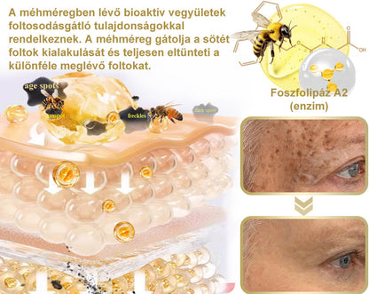 [Utánvétes fizetés] Méhméreg krém szemölcsök és anyajegyek eltávolítására (👨‍⚕ Bőrgyógyászok ajánlásával) 🐝 Utolsó nap – 70% kedvezmény! 🔥