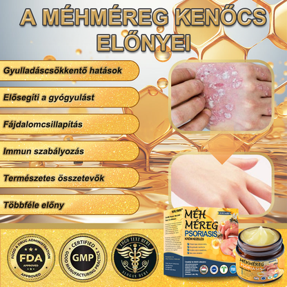 Ourlyard™ Méhméreg Haladó Psoriasis Kezelő Kenőcs (👨Orvos által ajánlott)