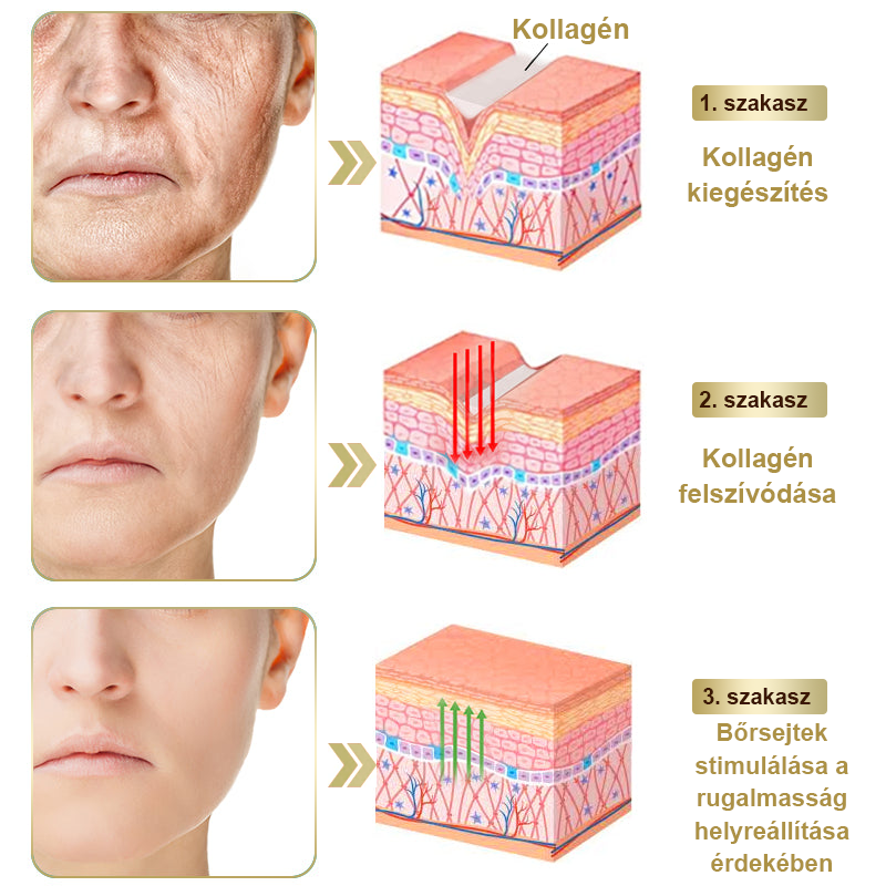 [Utánvétes fizetés] Méhméreg krém szemölcsök és anyajegyek eltávolítására (👨‍⚕ Bőrgyógyászok ajánlásával) 🐝 Utolsó nap – 70% kedvezmény! 🔥