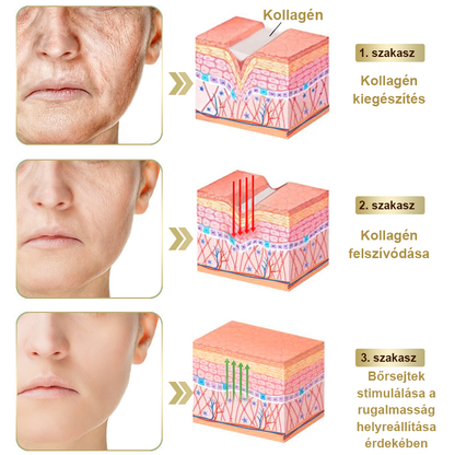 [Utánvétes fizetés] Méhméreg krém szemölcsök és anyajegyek eltávolítására (👨‍⚕ Bőrgyógyászok ajánlásával) 🐝 Utolsó nap – 70% kedvezmény! 🔥