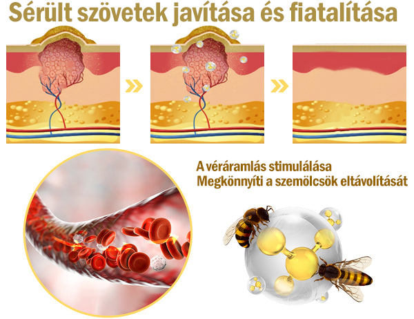 [Utánvétes fizetés] Méhméreg krém szemölcsök és anyajegyek eltávolítására (👨‍⚕ Bőrgyógyászok ajánlásával) 🐝 Utolsó nap – 70% kedvezmény! 🔥