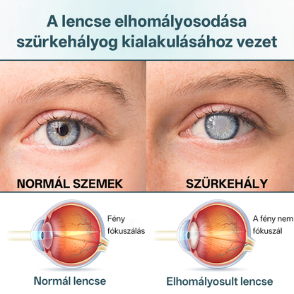✅Timilk® OptiFusion Nano szemcsepp szérum⭐⭐
