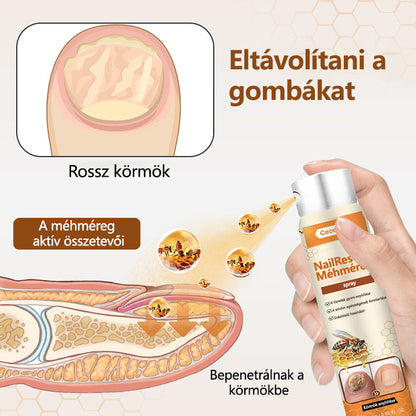 2025🎁 Korlátozott idejű akció 70% kedvezménnyel ️️⏳ Ceoerty® körömgomba spray méhméreggel 💥 2 hét alatt megoldja az összes körömproblémát