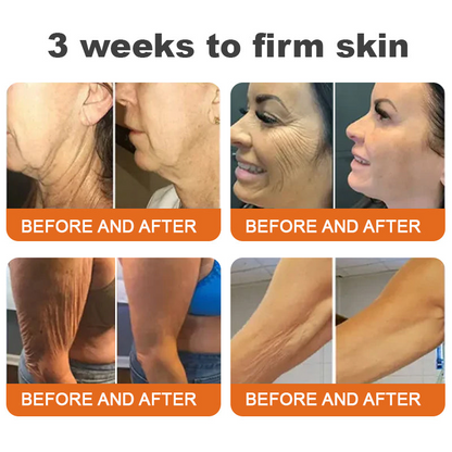 flysmus™ Botox Bee Venom bőrfeszesítő szérumstick (🔥Utolsó NAP 70% KEDVEZMÉNY)💄