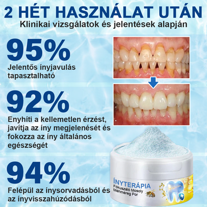 🇭🇺 Furzero® 𝑭𝒐𝒄𝒖𝒔𝒔𝒎𝒊𝒍𝒆 – Méhméreges szájápoló por 🦷