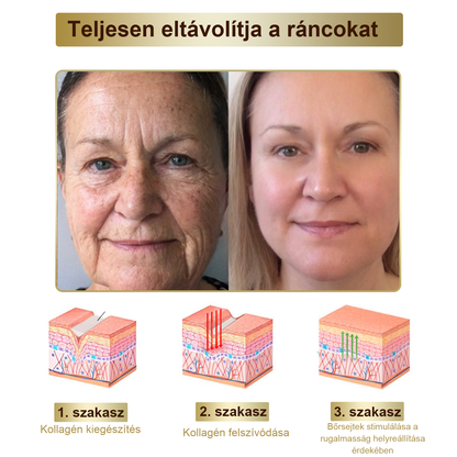 [Utánvétes fizetés] Méhméreg krém szemölcsök és anyajegyek eltávolítására (👨‍⚕ Bőrgyógyászok ajánlásával) 🐝 Utolsó nap – 70% kedvezmény! 🔥