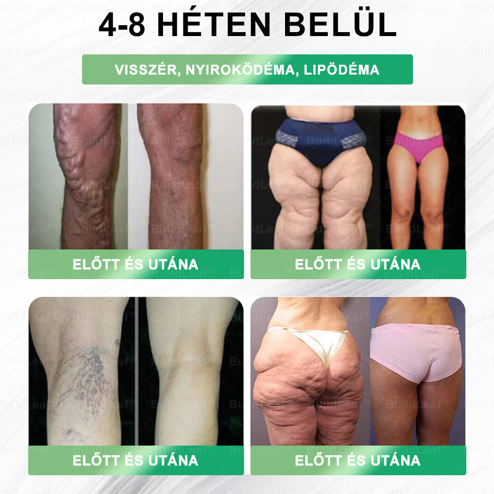 🧑‍⚕️🧑‍⚕️🌿🌿𝑩𝒖𝒊𝒍𝒅𝑳𝒆𝒂𝒇® 𝑮𝑳𝑷-1 8-𝒊𝒏-1 𝑭𝒊𝒕 & 𝑽𝒊𝒕𝒂𝒍 𝑺𝒛á𝒋𝒉𝒊𝒈𝒊é𝒏𝒊𝒂𝒊 𝑶𝒍𝒅𝒂𝒕 ✅ 𝑨𝒍𝒌𝒂𝒍𝒎𝒂𝒔 𝒆𝒍𝒉í𝒛á𝒔, 𝒔𝒛í𝒗- é𝒔 é𝒓𝒓𝒆𝒏𝒅𝒔𝒛𝒆𝒓𝒊 𝒆𝒈é𝒔𝒛𝒔é𝒈, 𝒄𝒖𝒌𝒐𝒓𝒃𝒆𝒕𝒆𝒈𝒔é𝒈, 𝒂𝒍𝒗á𝒔𝒊 𝒂𝒑𝒏𝒐𝒆, 𝒃é𝒍𝒓𝒆𝒏𝒅𝒔𝒛𝒆𝒓𝒊 𝒆𝒈é𝒔𝒛𝒔é𝒈, í𝒛ü𝒍𝒆𝒕𝒊 𝒑𝒓𝒐𝒃𝒍é𝒎á𝒌 é𝒔 𝒆𝒈𝒚é𝒃 𝒆𝒈é𝒔𝒛𝒔é𝒈ü𝒈𝒚𝒊 𝒊𝒈é𝒏𝒚𝒆𝒌 𝒆𝒔𝒆𝒕é𝒏