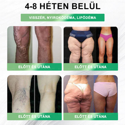 🧑‍⚕️🧑‍⚕️🌿🌿𝑩𝒖𝒊𝒍𝒅𝑳𝒆𝒂𝒇® 𝑮𝑳𝑷-1 8-𝒊𝒏-1 𝑭𝒊𝒕 & 𝑽𝒊𝒕𝒂𝒍 𝑺𝒛á𝒋𝒉𝒊𝒈𝒊é𝒏𝒊𝒂𝒊 𝑶𝒍𝒅𝒂𝒕 ✅ 𝑨𝒍𝒌𝒂𝒍𝒎𝒂𝒔 𝒆𝒍𝒉í𝒛á𝒔, 𝒔𝒛í𝒗- é𝒔 é𝒓𝒓𝒆𝒏𝒅𝒔𝒛𝒆𝒓𝒊 𝒆𝒈é𝒔𝒛𝒔é𝒈, 𝒄𝒖𝒌𝒐𝒓𝒃𝒆𝒕𝒆𝒈𝒔é𝒈, 𝒂𝒍𝒗á𝒔𝒊 𝒂𝒑𝒏𝒐𝒆, 𝒃é𝒍𝒓𝒆𝒏𝒅𝒔𝒛𝒆𝒓𝒊 𝒆𝒈é𝒔𝒛𝒔é𝒈, í𝒛ü𝒍𝒆𝒕𝒊 𝒑𝒓𝒐𝒃𝒍é𝒎á𝒌 é𝒔 𝒆𝒈𝒚é𝒃 𝒆𝒈é𝒔𝒛𝒔é𝒈ü𝒈𝒚𝒊 𝒊𝒈é𝒏𝒚𝒆𝒌 𝒆𝒔𝒆𝒕é𝒏