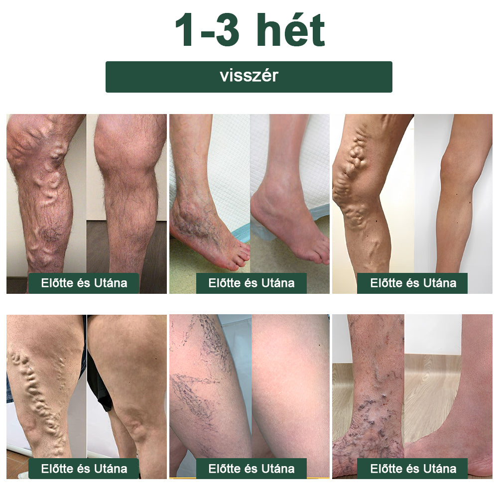 🔥 Már csak 5 üveg maradt! További 50% kedvezményt biztosítunk! Szerezzen magának egy egészséges testet. Ha most hiányzik, csak jövőre kapja meg.  🔥🔥