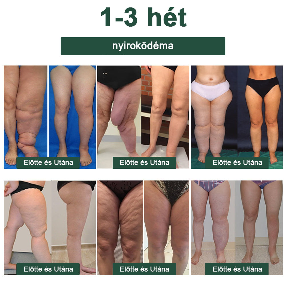 🔥 Már csak 5 üveg maradt! További 50% kedvezményt biztosítunk! Szerezzen magának egy egészséges testet. Ha most hiányzik, csak jövőre kapja meg.  🔥🔥