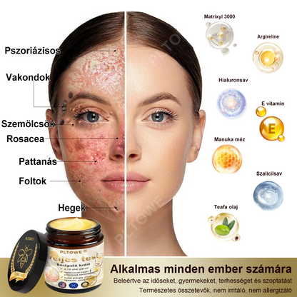 [Utánvétes fizetés] Méhméreg krém szemölcsök és anyajegyek eltávolítására (👨‍⚕ Bőrgyógyászok ajánlásával) 🐝 Utolsó nap – 70% kedvezmény! 🔥