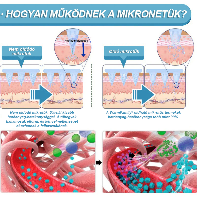 WarmFamily® SMGT-GLP-1 Nano Mikrotű Tapasz Kollagénnel és Matrixyl 3000-rel ✅ | Klinikailag bizonyított hatás fogyásra, szív- és érrendszeri egészségre, cukorbetegségre és egyéb egészségügyi problémákra, orvosok által ajánlott 👨‍⚕️