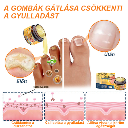 Ourlyard™ Méhméreg Haladó Psoriasis Kezelő Kenőcs (👨Orvos által ajánlott)