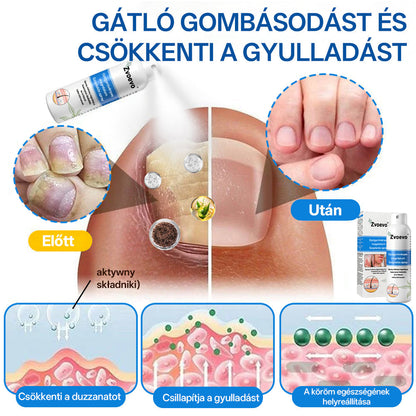 ✅ Hivatalos bolt: Zvoevo® Magnéziumos gyógynövényes spray pikkelysömörre ⚕️ MHRA tanúsítvánnyal (enyhíti a pikkelysömört, ekcémát, kezeli pattanásokat, szemölcsöket, javítja bakteriális fertőzéseket, csökkenti ízületi és neuropátiás fájdalmakat)